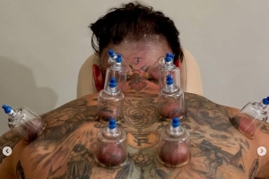 mk体育-密密麻麻！39岁拉莫斯昨日踢满全场，今日脖子胳膊等多处都在拔罐